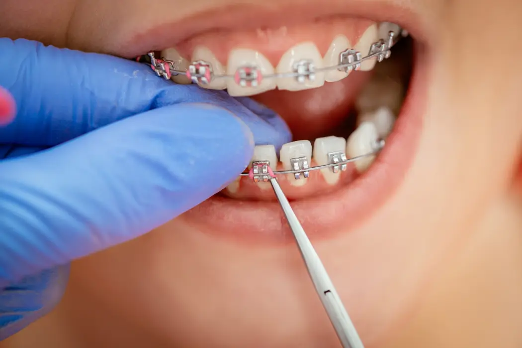 Jaki jest najlepszy czas na konsultację z ortodontą?